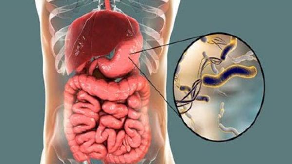 22 f99c923257 unnamed 1